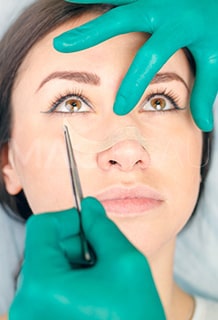 عملية تجميل الأنف